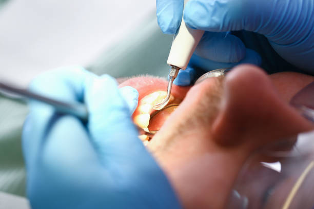 Best Broken or Cracked Tooth Emergency Dentist in Ocean Shores, WA