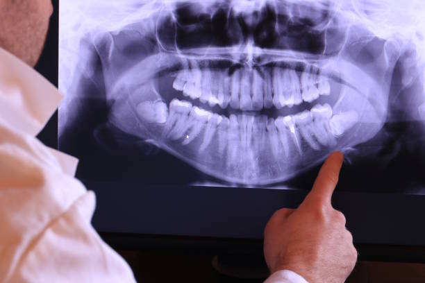 Best Mobile Emergency Dentist in Ocean Shores, WA