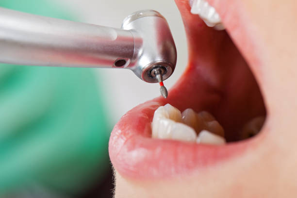 Best Pediatric Emergency Dentist in Ocean Shores, WA